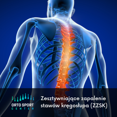 Zesztywniające zapalenie stawów kręgosłupa (ZZSK, choroba Bechterewa)